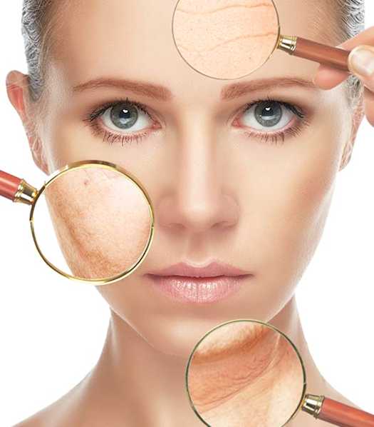 Zabiegi Na Popękane Naczynka