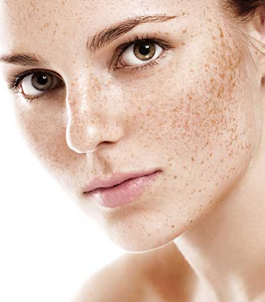 Zabiegi Dla Cery Z Przebarwieniami
